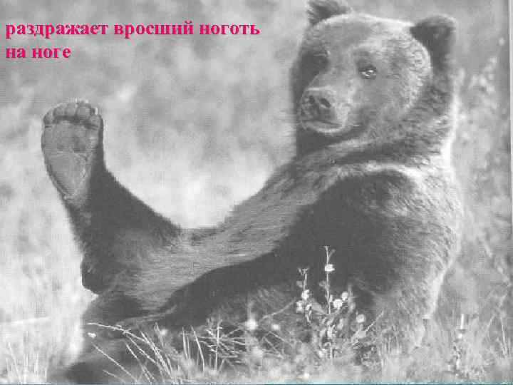 раздражает вросший ноготь на ноге 