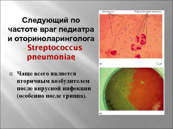 Следующий по частоте враг педиатра и оториноларинголога - Streptococcus pneumoniae ; Чаще всего является