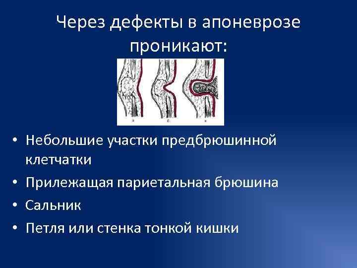  Через дефекты в апоневрозе   проникают: • Небольшие участки предбрюшинной  клетчатки
