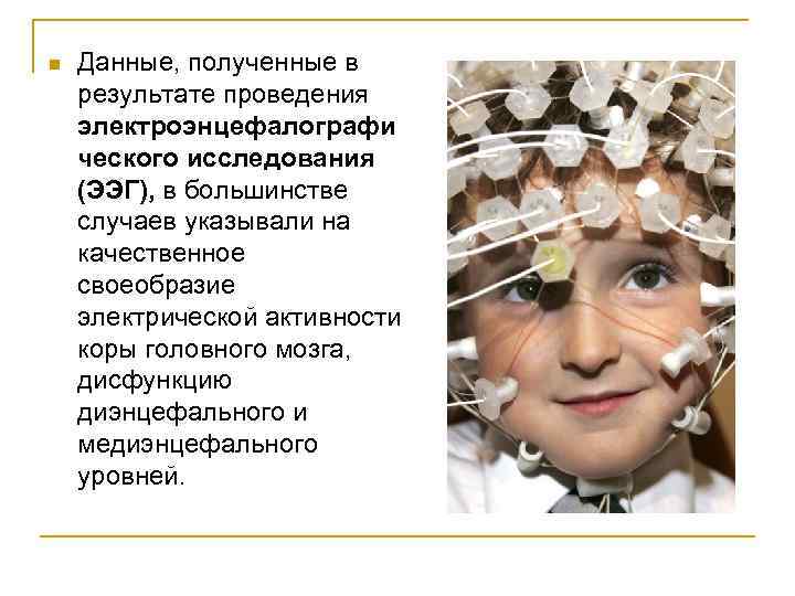 n Данные, полученные в результате проведения электроэнцефалографи ческого исследования (ЭЭГ), в большинстве случаев указывали