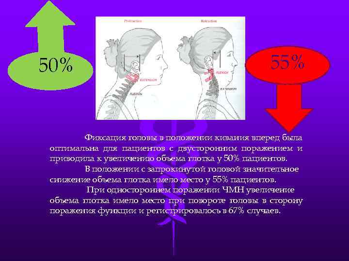 50%        55%   Фиксация головы в