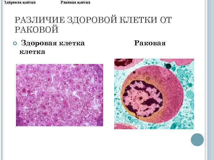 Нормальные клетки. Раковая клетка строение. Строение раковой клетки. Нормальная клетка и раковая. Клетка строение раковой клетки.