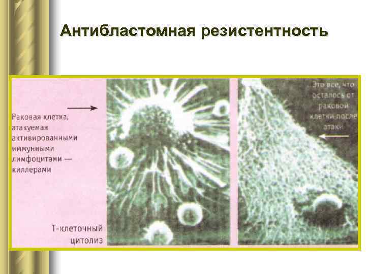 Антибластомная резистентность 