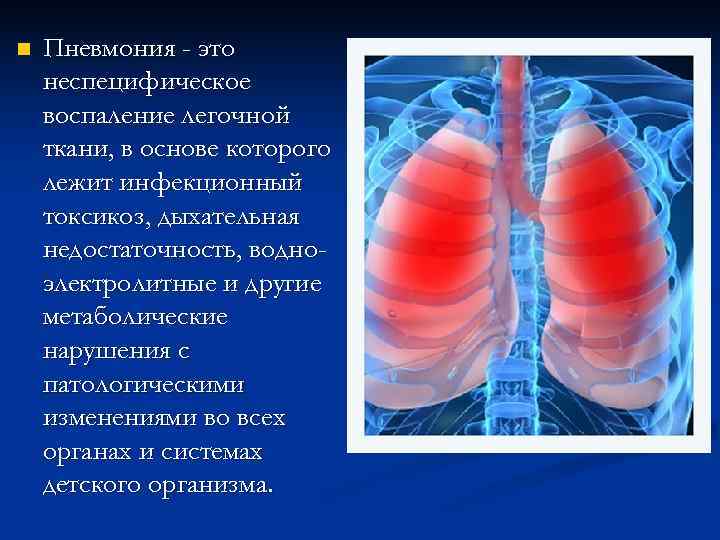 n  Пневмония - это неспецифическое воспаление легочной ткани, в основе которого лежит инфекционный
