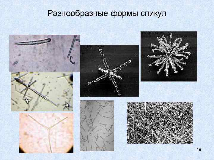 Разнообразные формы спикул       18 