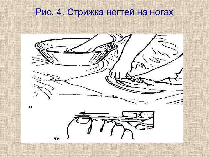 Рис. 4. Стрижка ногтей на ногах 