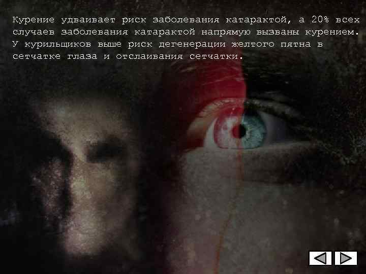 Курение удваивает риск заболевания катарактой, а 20% всех случаев заболевания катарактой напрямую вызваны курением.
