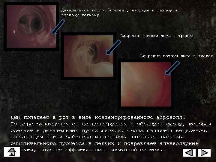    Дыхательное горло (трахея), ведущее к левому и   правому
