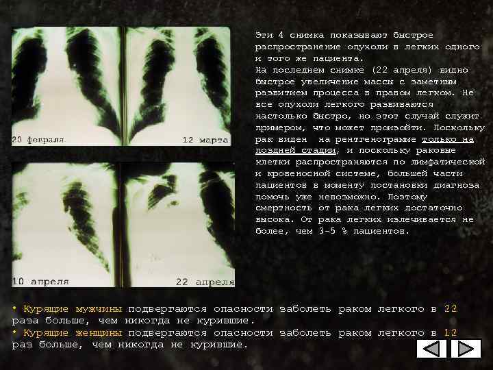        Эти 4 снимка показывают быстрое  