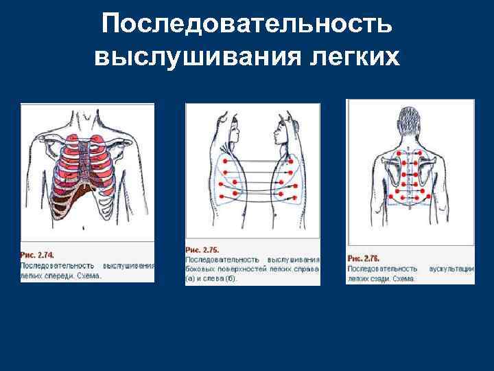 Последовательность выслушивания легких 