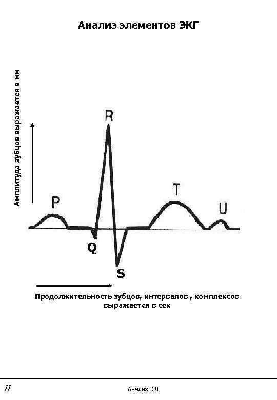 Анализ экг