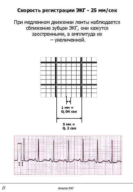 Регистрация экг