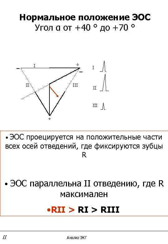 Нормальное положение ЭОС   Угол α от +40 ° до +70 °