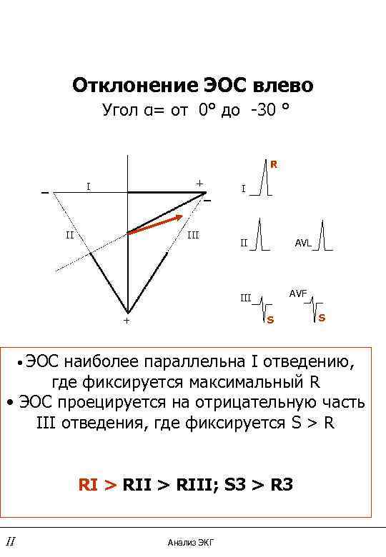 Экг резкое отклонение влево