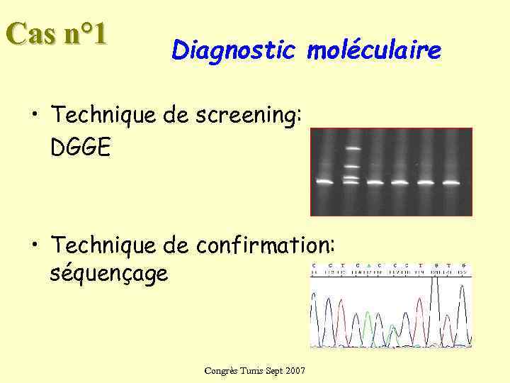 Cas n° 1 Diagnostic moléculaire  • Technique de screening: DGGE • Technique de