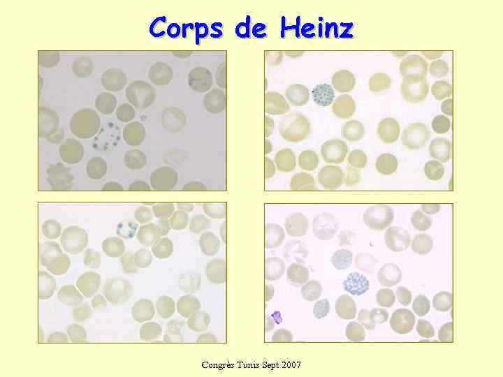 Corps de Heinz  Congrès Tunis Sept 2007 