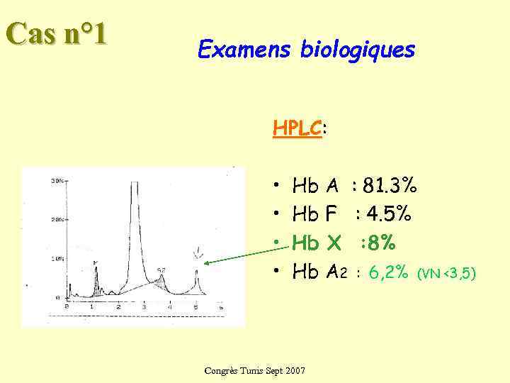 Cas n° 1  Examens biologiques      HPLC:  