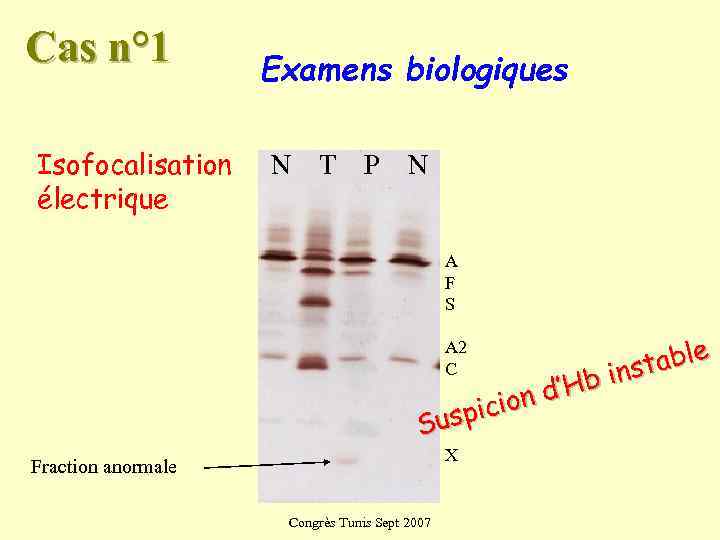 Cas n° 1   Examens biologiques Isofocalisation N  T  P N