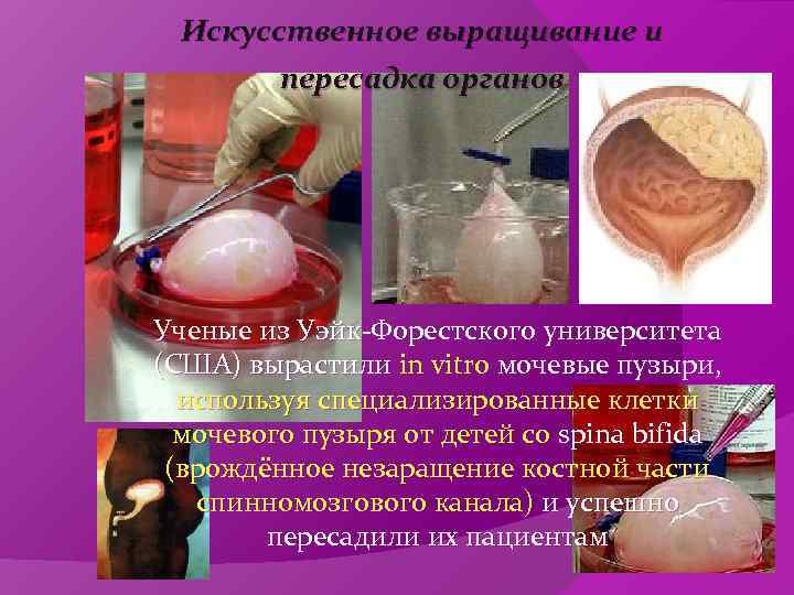  Искусственное выращивание и   пересадка органов Ученые из Уэйк-Форестского университета (США) вырастили