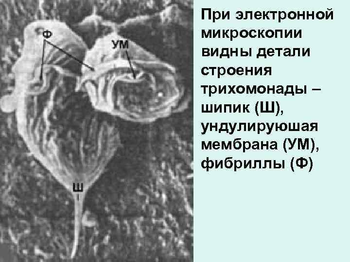 При электронной микроскопии видны детали строения трихомонады – шипик (Ш), ундулируюшая мембрана (УМ), фибриллы