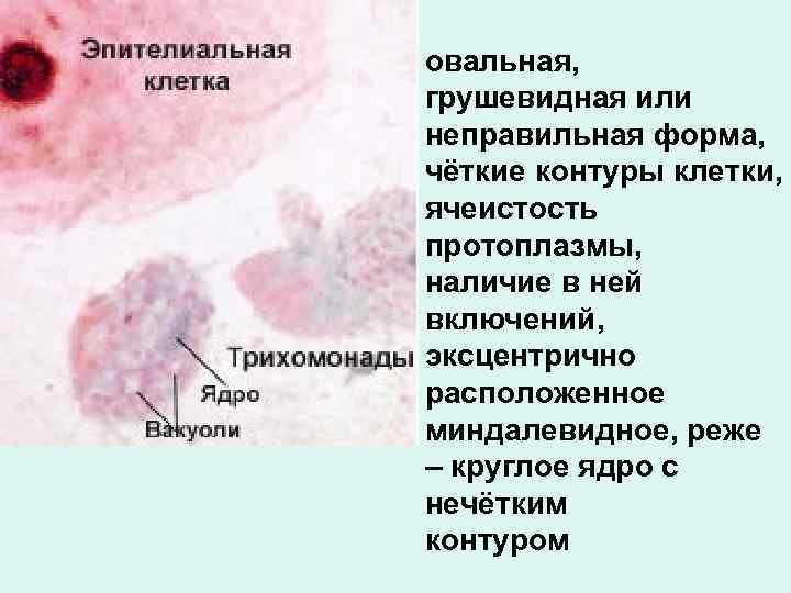овальная, грушевидная или неправильная форма, чёткие контуры клетки, ячеистость протоплазмы, наличие в ней включений,