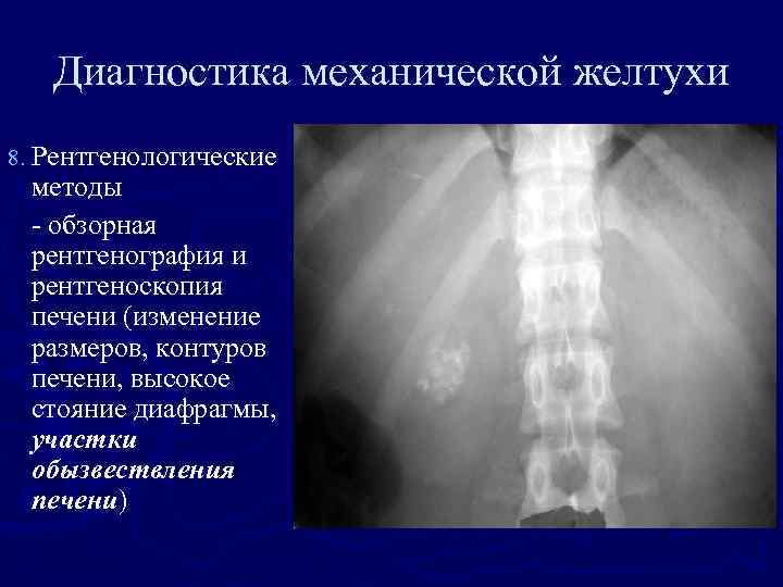 Механическая желтуха карта смп