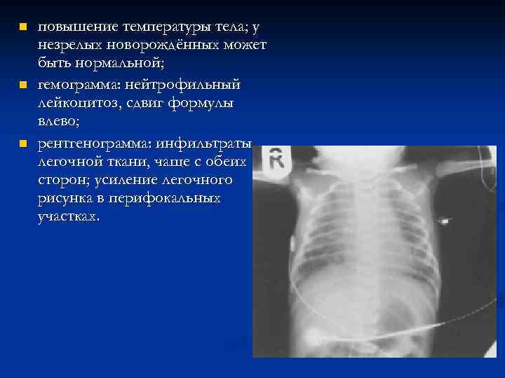 n n n повышение температуры тела; у незрелых новорождённых может быть нормальной; гемограмма: нейтрофильный