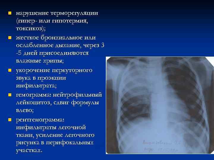 n n n нарушение терморегуляции (гипер- или гипотермия, токсикоз); жесткое бронхиальное или ослабленное дыхание,