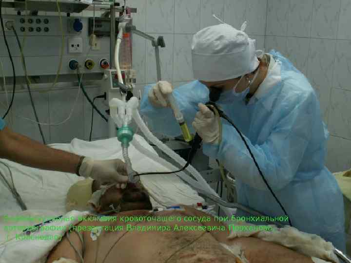 Эндоваскулярная окклюзия кровоточащего сосуда при бронхиальной артериографии (презентация Владимира Алексеевича Порханова,  г. Краснодар)