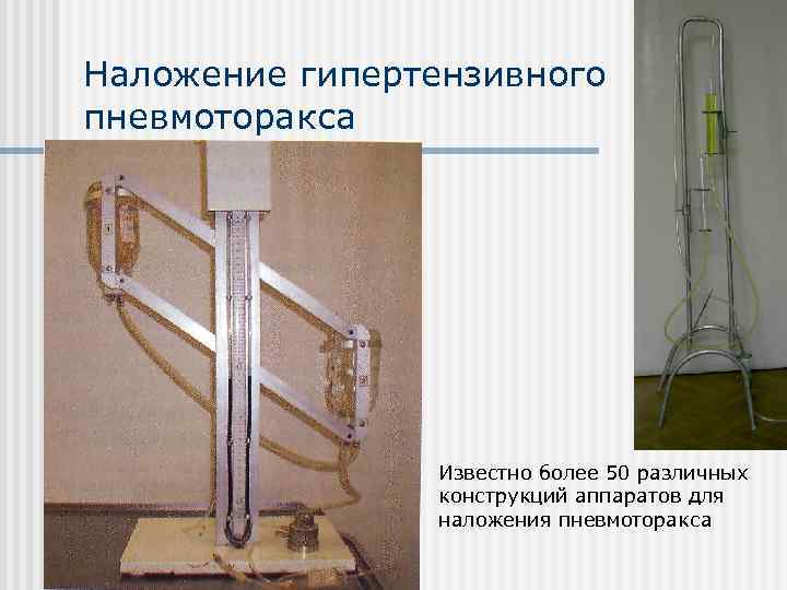 Наложение гипертензивного пневмоторакса     Известно более 50 различных   конструкций