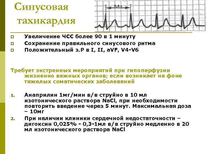  Синусовая тахикардия p  Увеличение ЧСС более 90 в 1 минуту p 