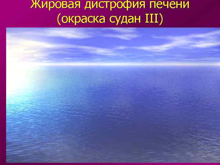 Жировая дистрофия печени  (окраска судан III) 