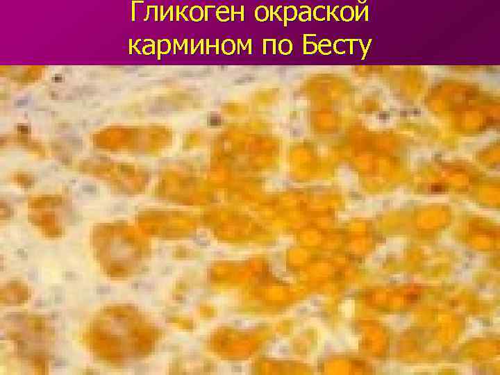 Гликоген окраской кармином по Бесту 