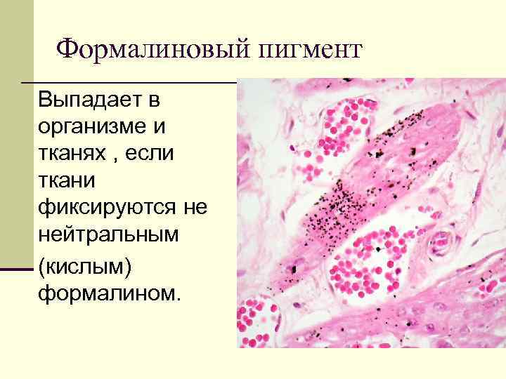 Формалиновый пигмент Выпадает в организме и тканях , если ткани фиксируются не нейтральным