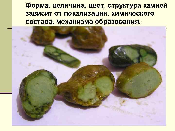 Форма, величина, цвет, структура камней зависит от локализации, химического состава, механизма образования. 