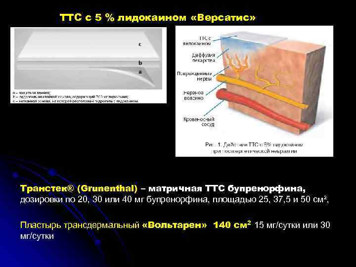 ТТС с 5 % лидокаином «Версатис» Транстек® (Grunenthal) – матричная ТТС бупренорфина, дозировки по