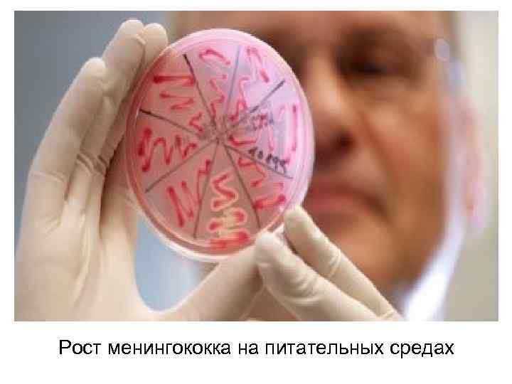 Рост менингококка на питательных средах 