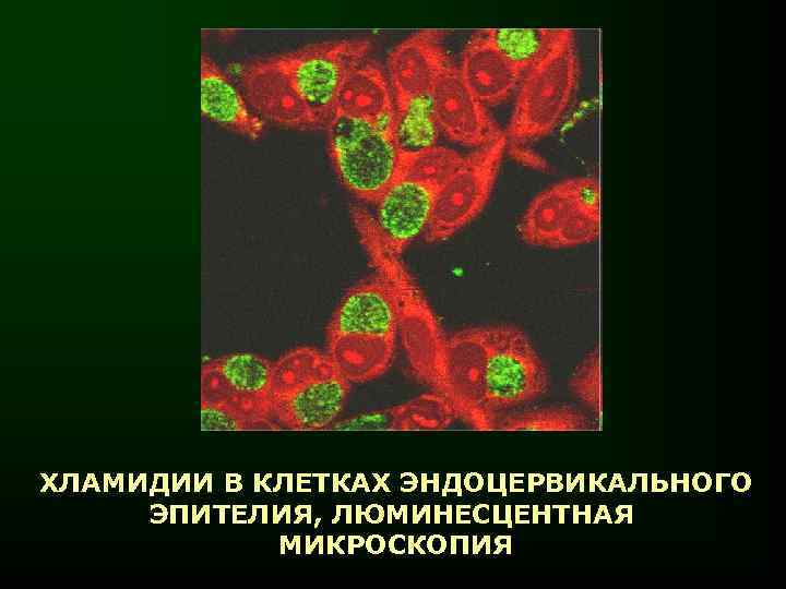День хламидии. Хламидии люминесцентная микроскопия. Хламидии в эндоцервикальных клетках, люминесцентная микроскопия.. Хламидия пситаци морфология.