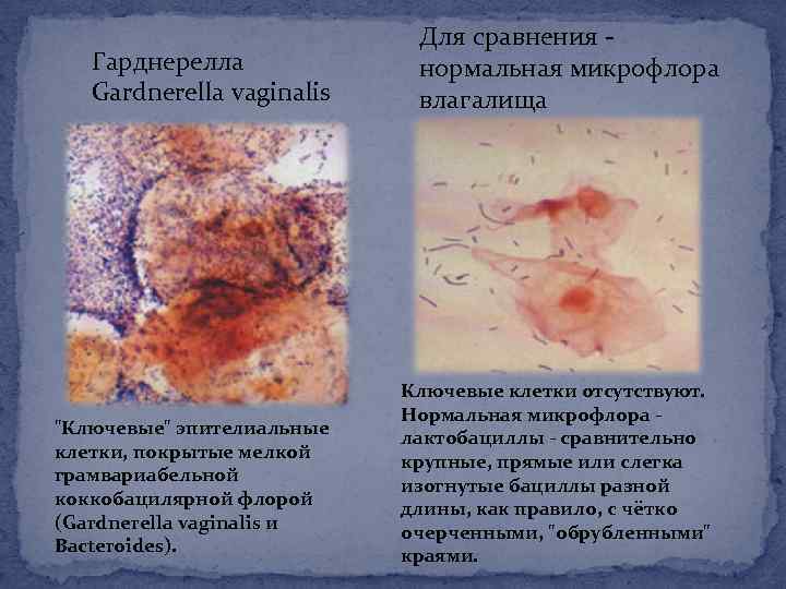 Урогенитальный микоплазмоз презентация