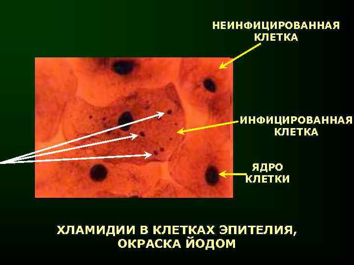    НЕИНФИЦИРОВАННАЯ    КЛЕТКА     ИНФИЦИРОВАННАЯ 