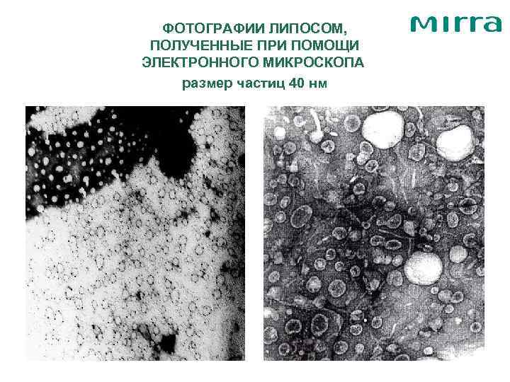  ФОТОГРАФИИ ЛИПОСОМ,  ПОЛУЧЕННЫЕ ПРИ ПОМОЩИ ЭЛЕКТРОННОГО МИКРОСКОПА размер частиц 40 нм 