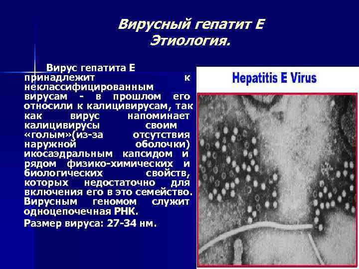    Вирусный гепатит Е     Этиология. Вирус гепатита Е
