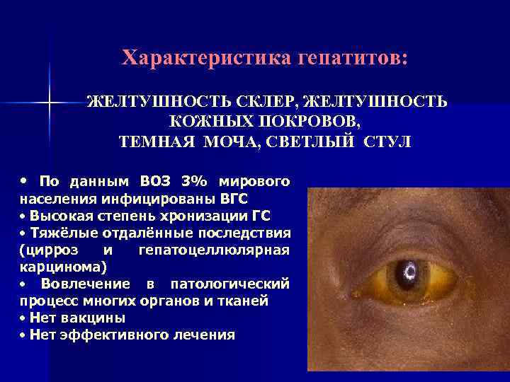   Характеристика гепатитов:   ЖЕЛТУШНОСТЬ СКЛЕР, ЖЕЛТУШНОСТЬ   КОЖНЫХ ПОКРОВОВ, 