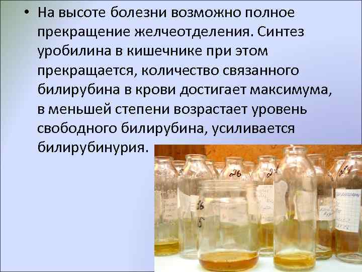  • На высоте болезни возможно полное  прекращение желчеотделения. Синтез  уробилина в