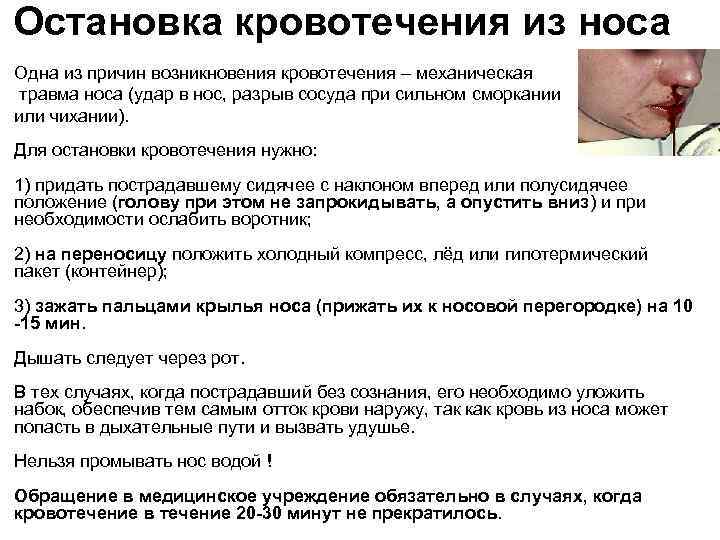 Остановка кровотечения из носа Одна из причин возникновения кровотечения – механическая травма носа (удар Остановка кровотечения из носа Одна из причин возникновения кровотечения – механическая травма носа (удар