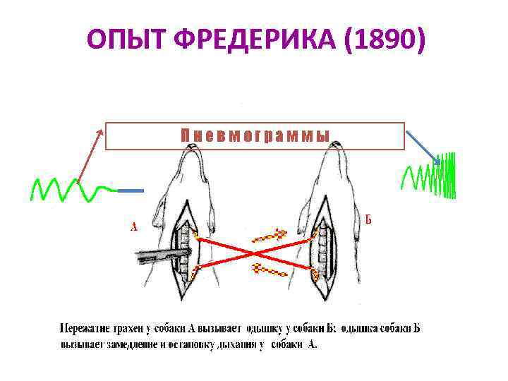 ОПЫТ ФРЕДЕРИКА (1890)  Пневмограммы 