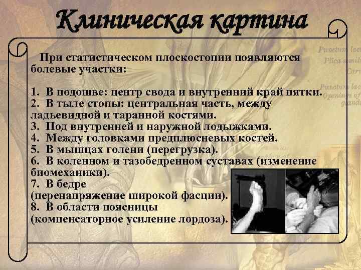   Клиническая картина  При статистическом плоскостопии появляются болевые участки: 1.  В