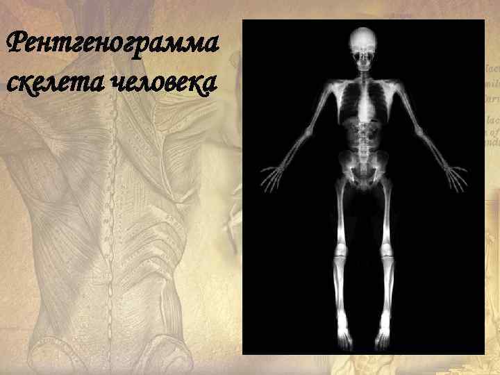 Рентгенограмма скелета человека 