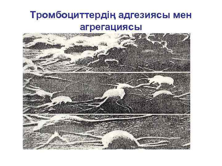 Тромбоциттердің адгезиясы мен   агрегациясы 