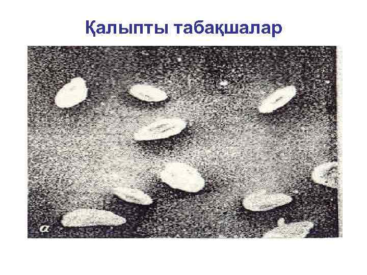 Қалыпты табақшалар 